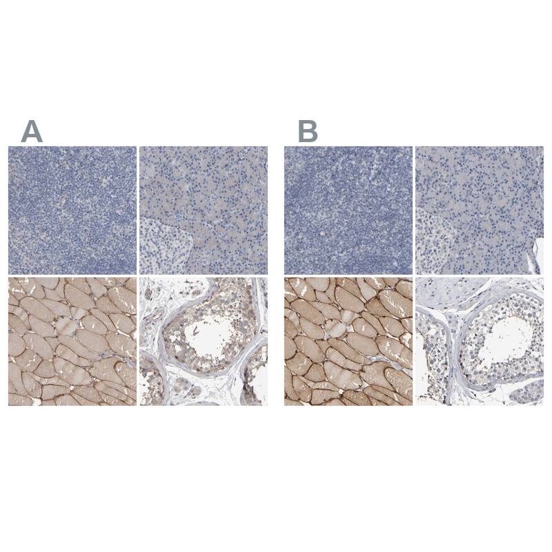 MURC Antibody - BSA Free Immunohistochemistry-Paraffin: MURC Antibody - BSA Free [NBP1-86607]