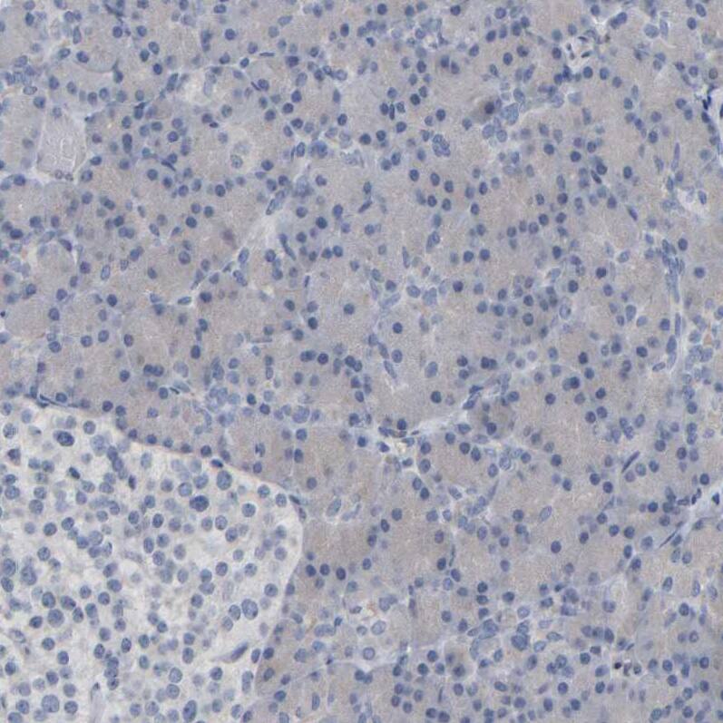 MURC Antibody - BSA Free Immunohistochemistry-Paraffin: MURC Antibody - BSA Free [NBP1-86607]