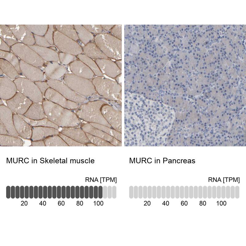 MURC Antibody - BSA Free Immunohistochemistry-Paraffin: MURC Antibody - BSA Free [NBP1-86607]