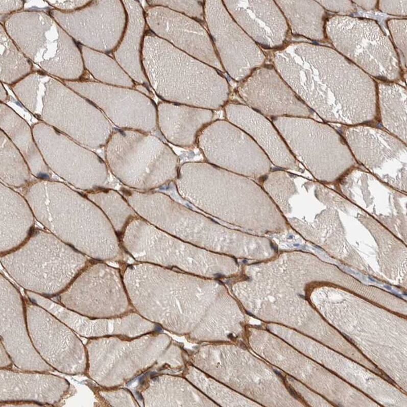 MURC Antibody - BSA Free Immunohistochemistry-Paraffin: MURC Antibody - BSA Free [NBP1-86608]