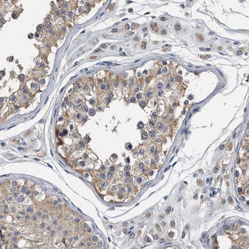 MURC Antibody - BSA Free Immunohistochemistry-Paraffin: MURC Antibody - BSA Free [NBP1-86608]