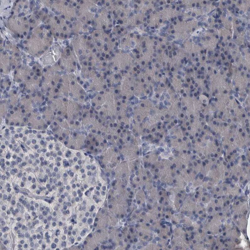 MURC Antibody - BSA Free Immunohistochemistry-Paraffin: MURC Antibody - BSA Free [NBP1-86608]