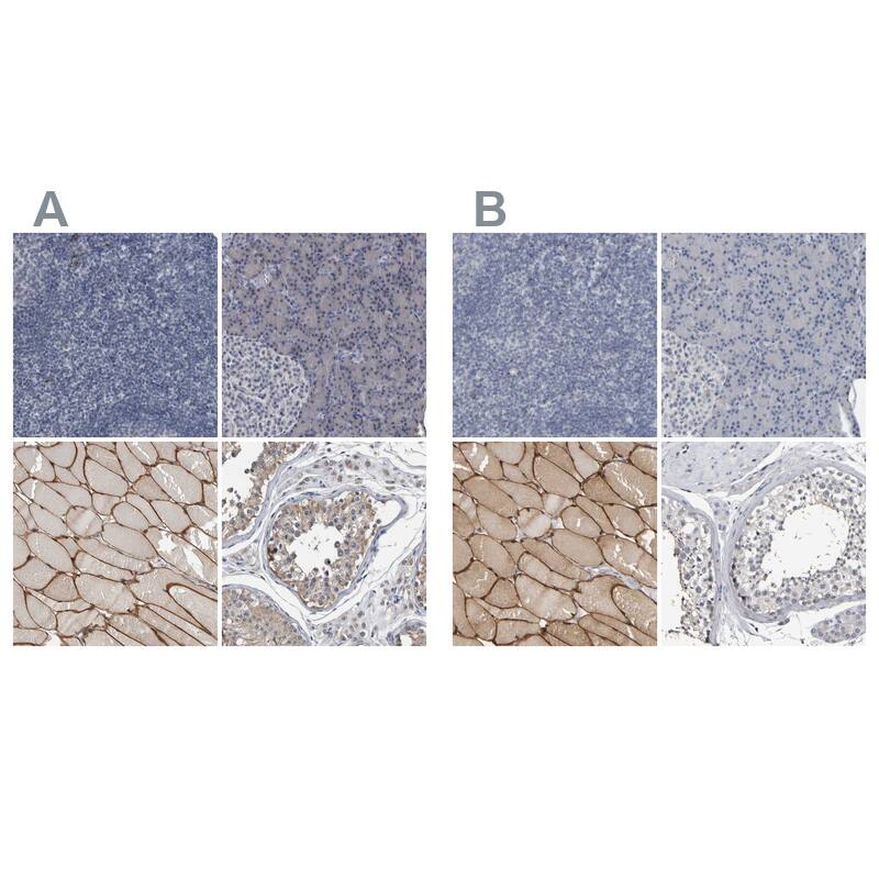 MURC Antibody - BSA Free Immunohistochemistry-Paraffin: MURC Antibody - BSA Free [NBP1-86608]
