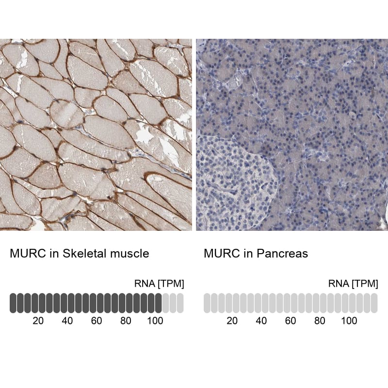 MURC Antibody - BSA Free Immunohistochemistry-Paraffin: MURC Antibody - BSA Free [NBP1-86608]