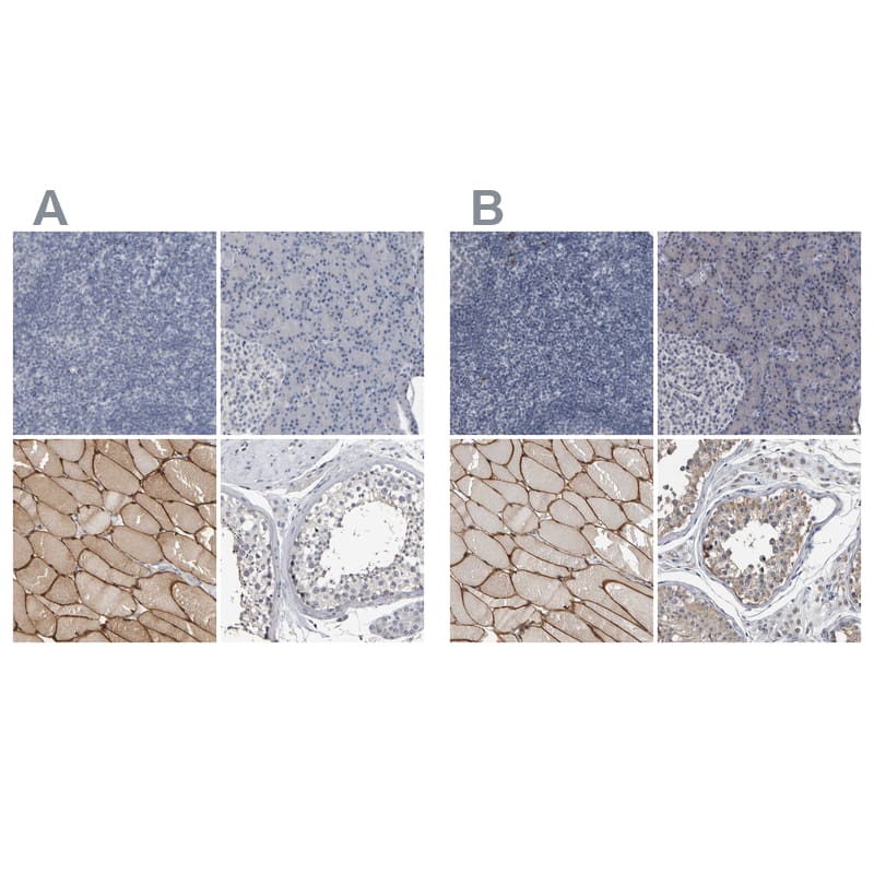 MURC Antibody - BSA Free Immunohistochemistry-Paraffin: MURC Antibody - BSA Free [NBP1-86609]