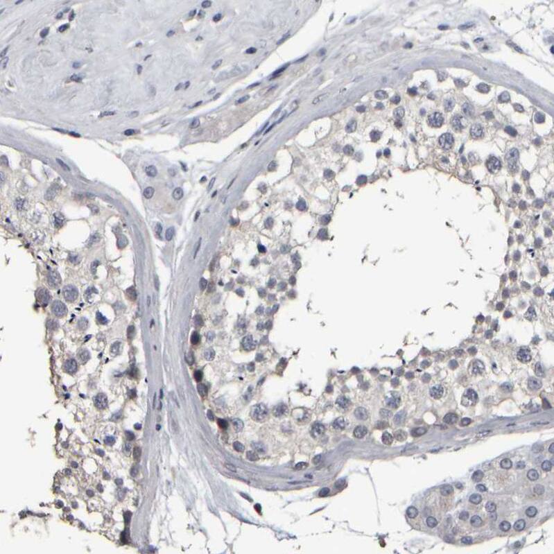 MURC Antibody - BSA Free Immunohistochemistry-Paraffin: MURC Antibody - BSA Free [NBP1-86609]
