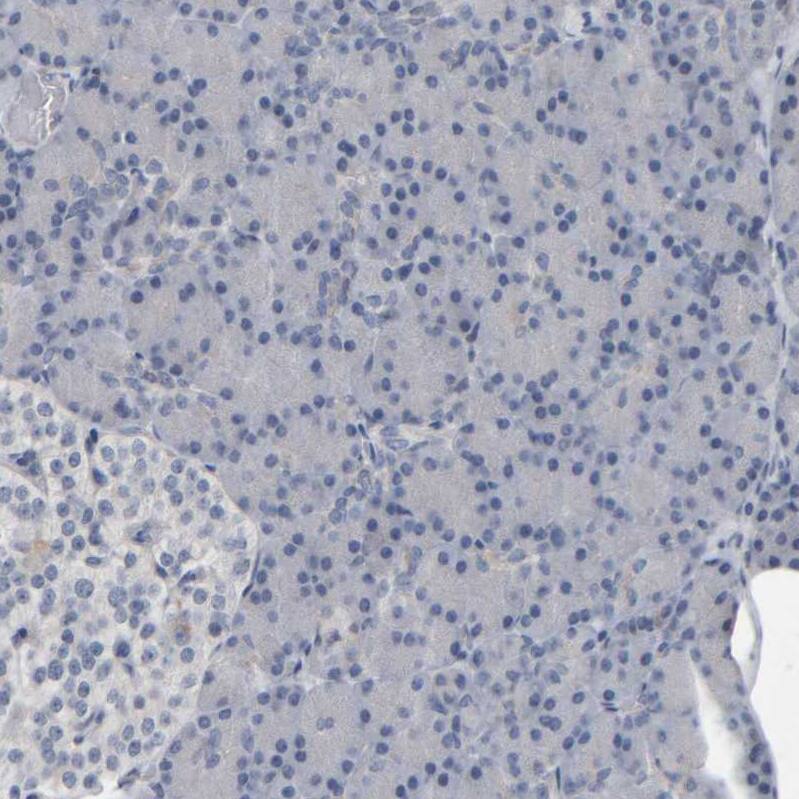 MURC Antibody - BSA Free Immunohistochemistry-Paraffin: MURC Antibody - BSA Free [NBP1-86609]