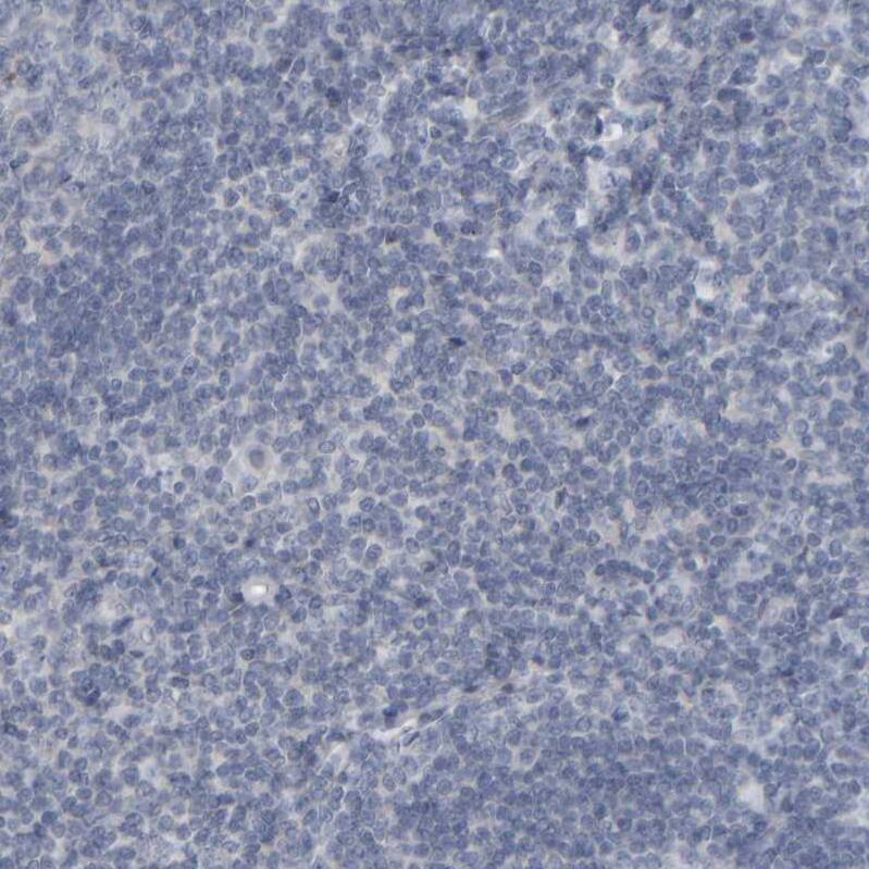 MURC Antibody - BSA Free Immunohistochemistry-Paraffin: MURC Antibody - BSA Free [NBP1-86609]