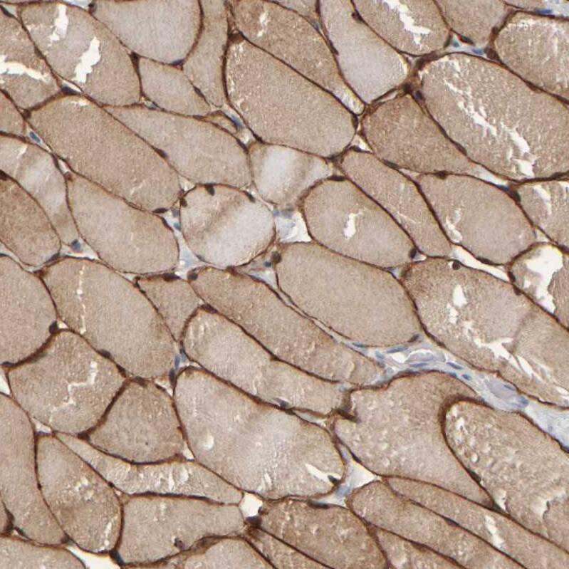 MURC Antibody - BSA Free Immunohistochemistry-Paraffin: MURC Antibody - BSA Free [NBP1-86609]