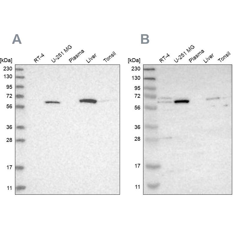 CRAT Antibody - BSA Free Western Blot: CRAT Antibody - BSA Free [NBP1-86614]