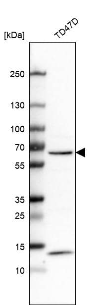 CRAT Antibody - BSA Free Western Blot: CRAT Antibody - BSA Free [NBP1-86616]