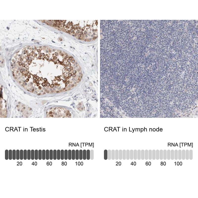 CRAT Antibody - BSA Free Immunohistochemistry-Paraffin: CRAT Antibody - BSA Free [NBP1-86616]