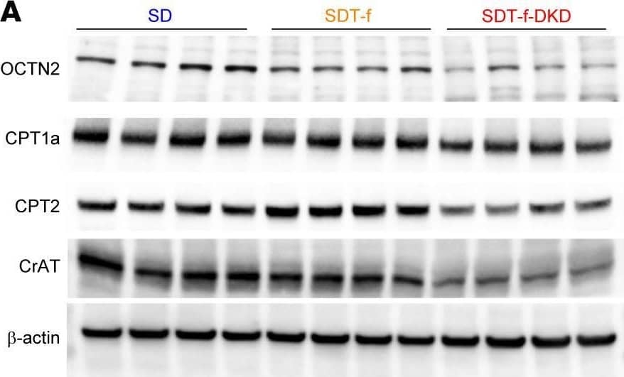 CRAT Antibody - BSA Free