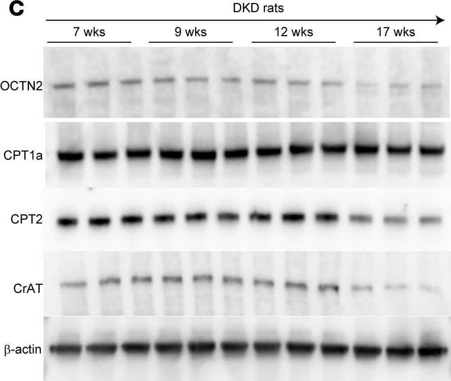 CRAT Antibody - BSA Free