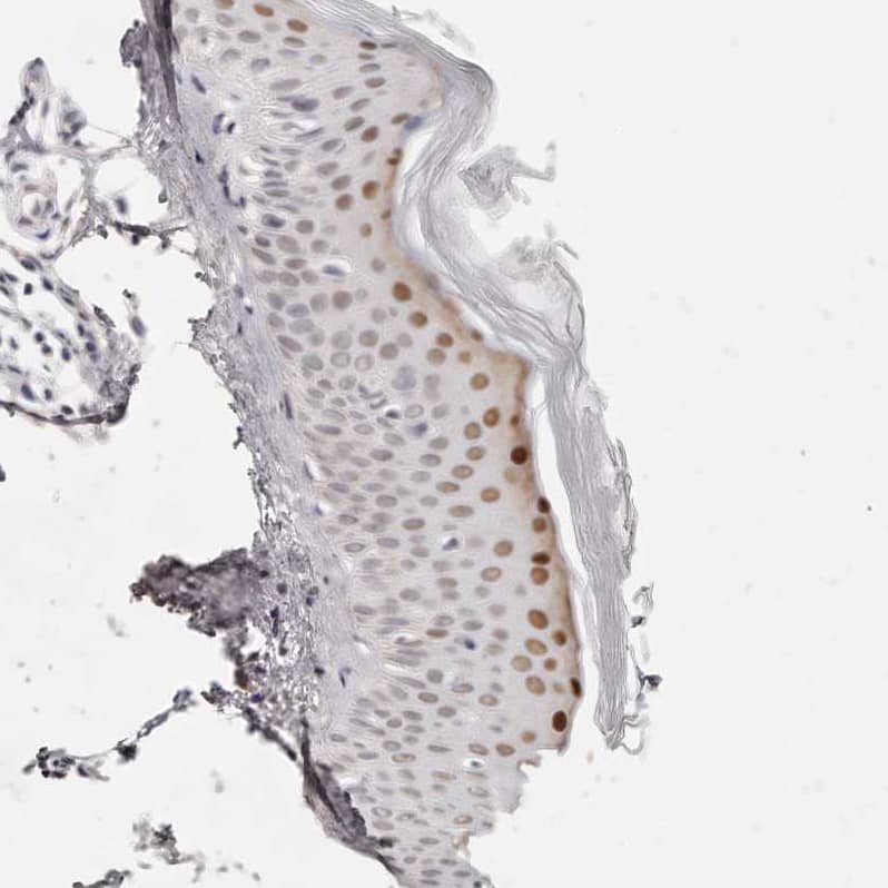 CASZ1 Antibody - BSA Free Immunohistochemistry-Paraffin: CASZ1 Antibody - BSA Free [NBP1-86617]