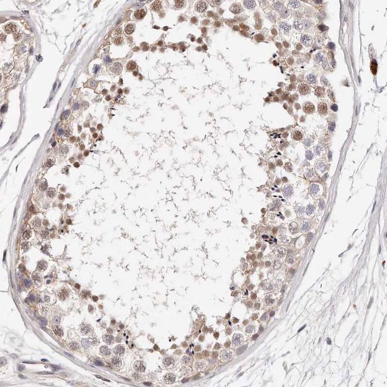 CASZ1 Antibody - BSA Free Immunohistochemistry-Paraffin: CASZ1 Antibody - BSA Free [NBP1-86617]