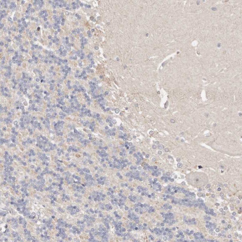 CASZ1 Antibody - BSA Free Immunohistochemistry-Paraffin: CASZ1 Antibody - BSA Free [NBP1-86617]