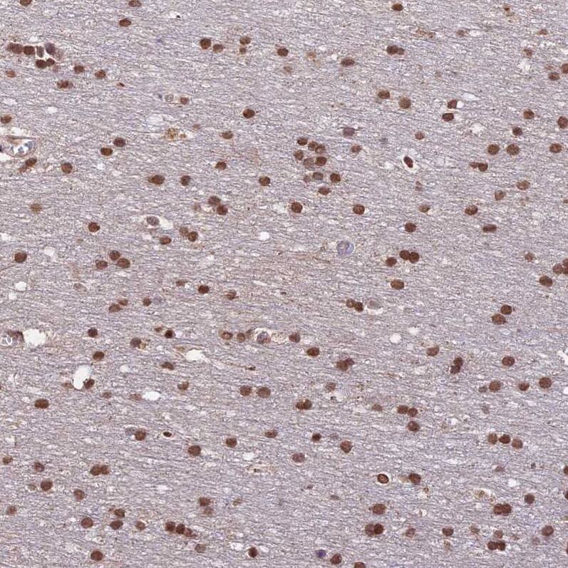 CARF/CDKN2AIP Antibody - BSA Free Immunohistochemistry-Paraffin: CARF/CDKN2AIP Antibody - BSA Free [NBP1-86628]