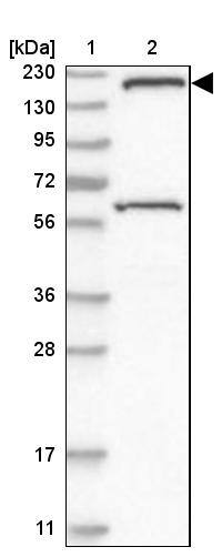 SMC4 Antibody - BSA Free Western Blot: SMC4 Antibody - BSA Free [NBP1-86635]