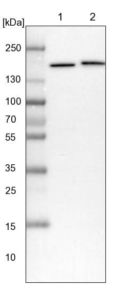 SMC4 Antibody - BSA Free Western Blot: SMC4 Antibody - BSA Free [NBP1-86635]
