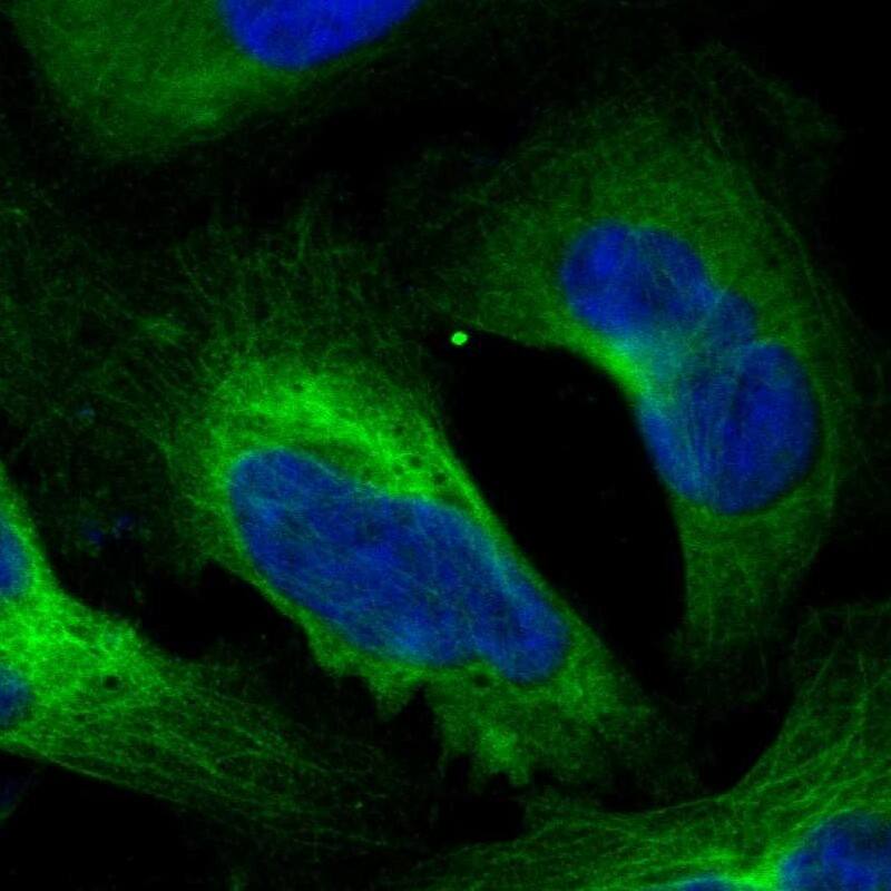 NDRG1 Antibody - BSA Free Immunohistochemistry-Paraffin: NDRG1 Antibody - BSA Free [NBP1-86636]