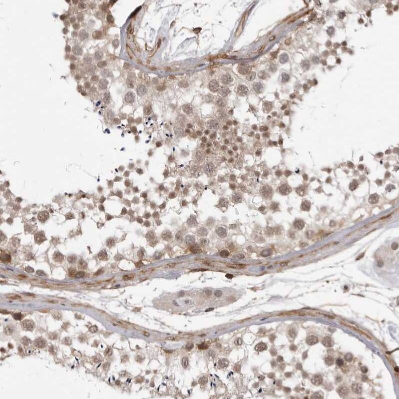 SORBS1 Antibody - BSA Free Immunohistochemistry-Paraffin: SORBS1 Antibody - BSA Free [NBP1-86641]