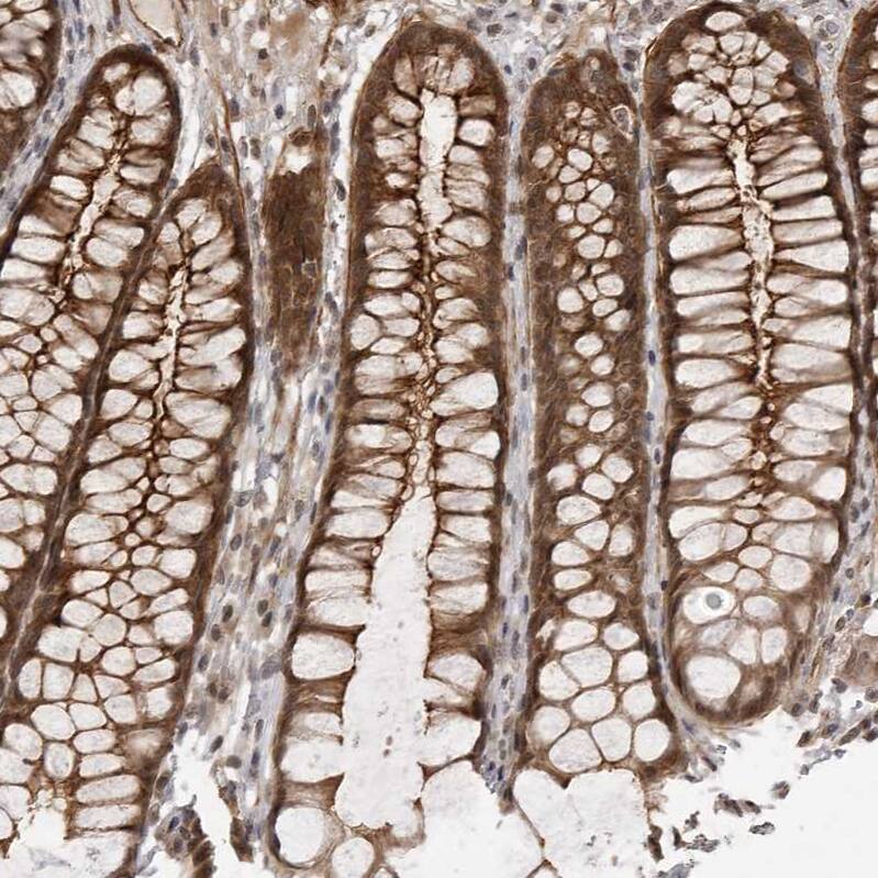 SORBS1 Antibody - BSA Free Immunohistochemistry-Paraffin: SORBS1 Antibody - BSA Free [NBP1-86641]