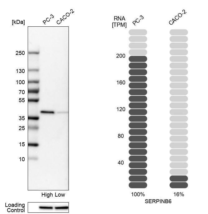 Serpin B6 Antibody - BSA Free Western Blot: Serpin B6 Antibody - BSA Free [NBP1-86642]