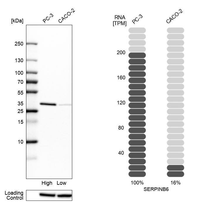Serpin B6 Antibody - BSA Free Western Blot: Serpin B6 Antibody - BSA Free [NBP1-86643]