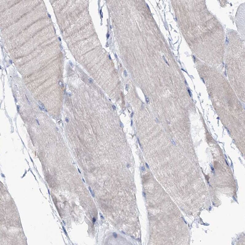 FAM111B Antibody - BSA Free Immunohistochemistry-Paraffin: FAM111B Antibody [NBP1-86645]
