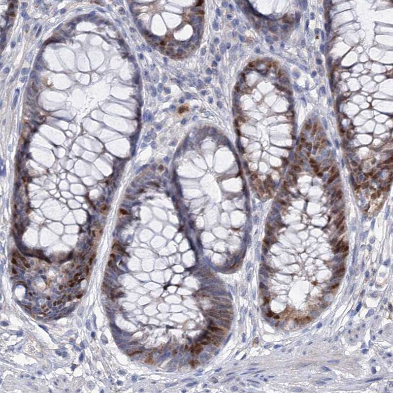 FAM111B Antibody - BSA Free Immunohistochemistry-Paraffin: FAM111B Antibody [NBP1-86645]