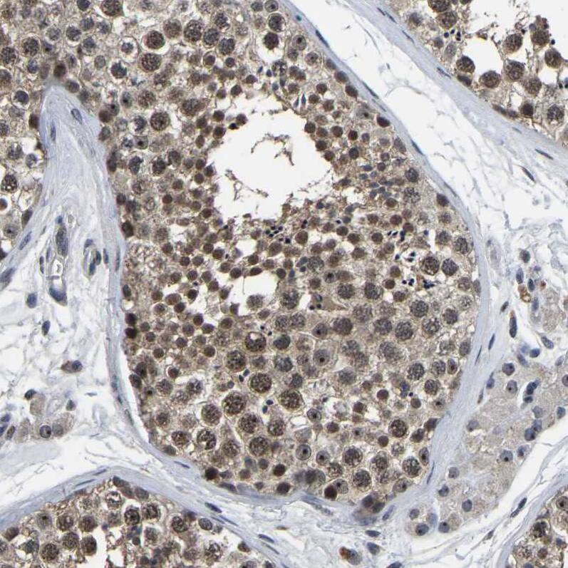 PPM1E Antibody - BSA Free Immunohistochemistry-Paraffin: PPM1E Antibody - BSA Free [NBP1-86649]