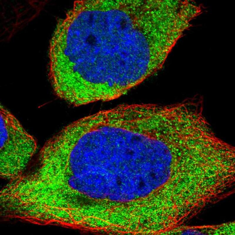 CaMKK2 Antibody - BSA Free Immunocytochemistry/ Immunofluorescence: CaMKK2 Antibody [NBP1-86651]
