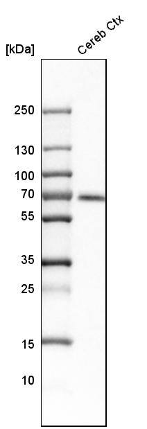 CaMKK2 Antibody - BSA Free Western Blot: CaMKK2 Antibody - BSA Free [NBP1-86651]
