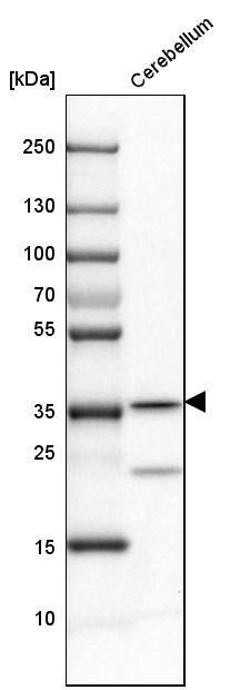 Carbonic Anhydrase VIII/CA8 Antibody - BSA Free Western Blot: Carbonic Anhydrase VIII/CA8 Antibody - BSA Free [NBP1-86654]