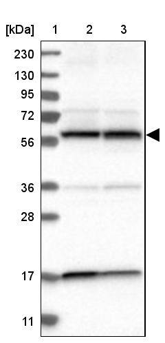 PPP3CC Antibody - BSA Free Western Blot: PPP3CC Antibody - BSA Free [NBP1-86656]