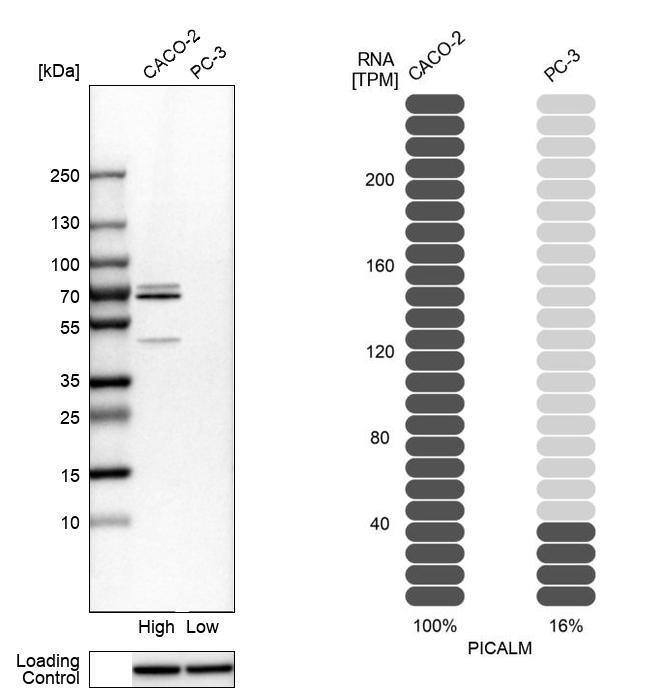 PICALM Antibody - BSA Free Western Blot: PICALM Antibody - BSA Free [NBP1-86658]
