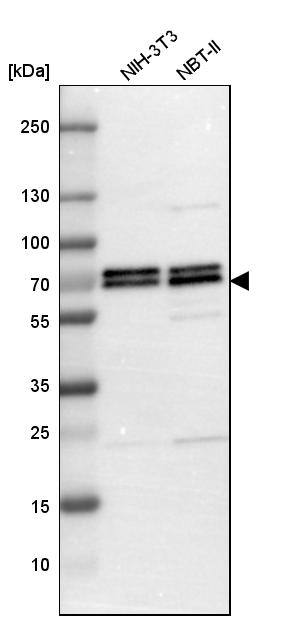 PICALM Antibody - BSA Free Western Blot: PICALM Antibody - BSA Free [NBP1-86659]