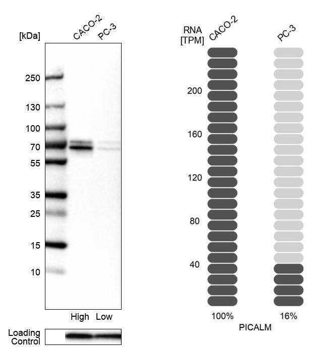 PICALM Antibody - BSA Free Western Blot: PICALM Antibody - BSA Free [NBP1-86659]