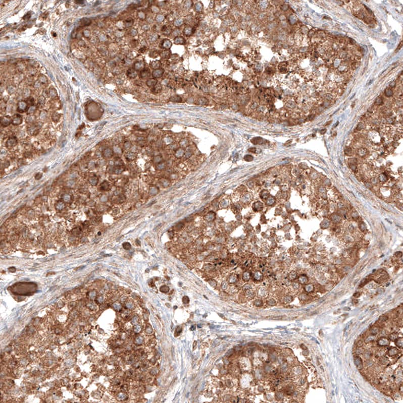 TAX1BP1 Antibody - BSA Free Immunohistochemistry-Paraffin: TAX1BP1 Antibody [NBP1-86662]