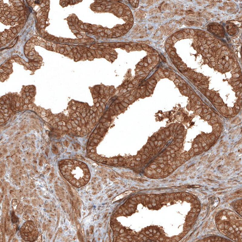 TAX1BP1 Antibody - BSA Free Immunohistochemistry-Paraffin: TAX1BP1 Antibody [NBP1-86662]