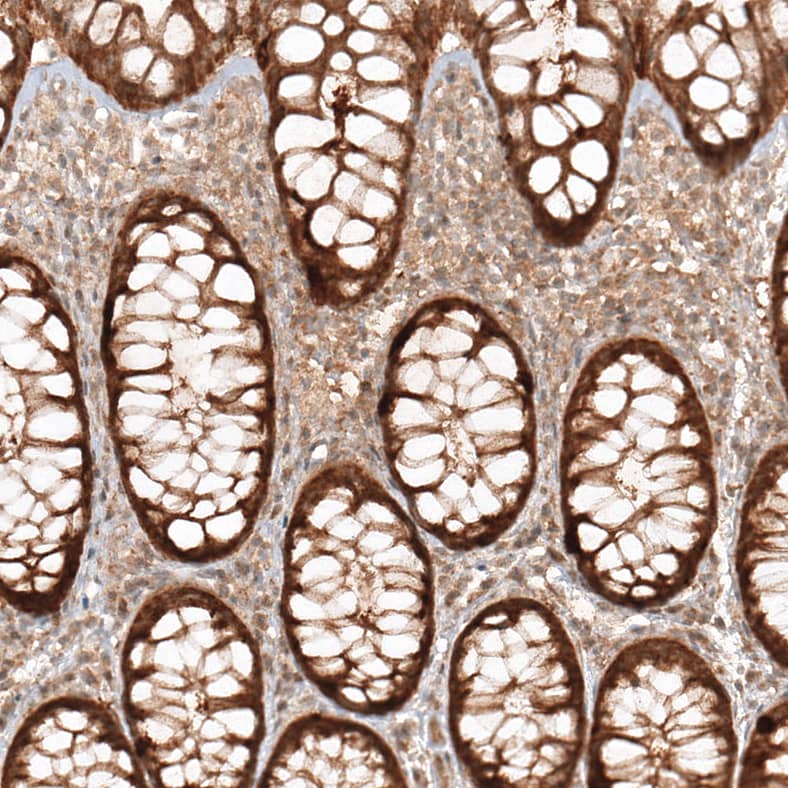 CBARA1 Antibody - BSA Free Immunohistochemistry-Paraffin: CBARA1 Antibody [NBP1-86663]