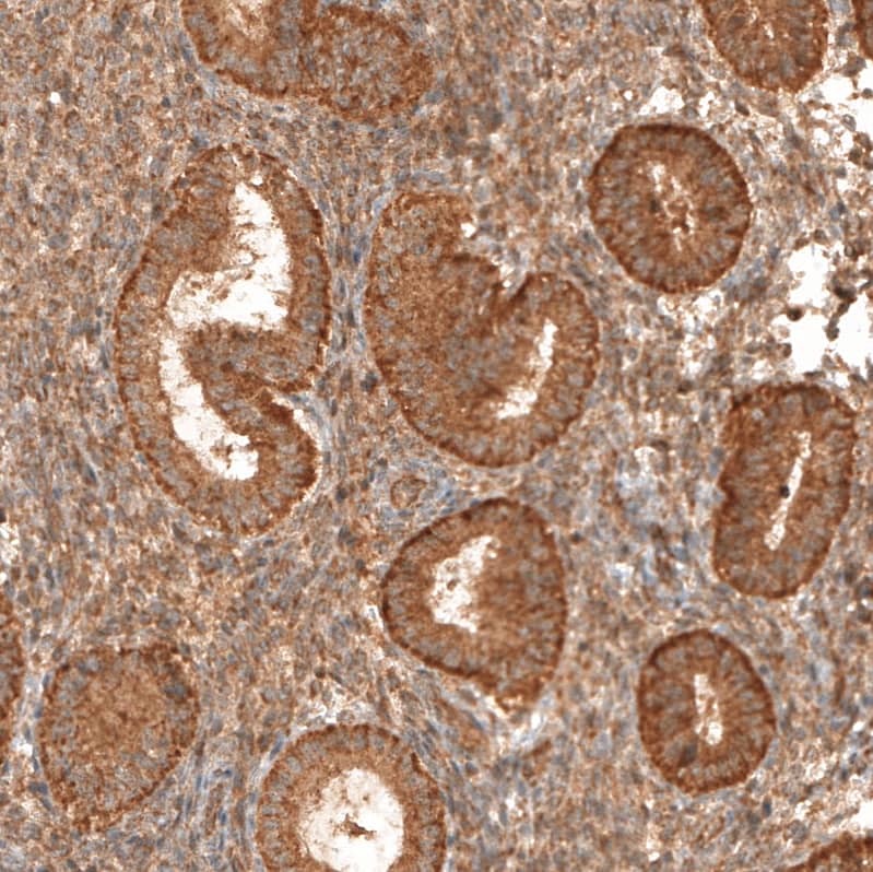 CBARA1 Antibody - BSA Free Immunohistochemistry-Paraffin: CBARA1 Antibody [NBP1-86663]