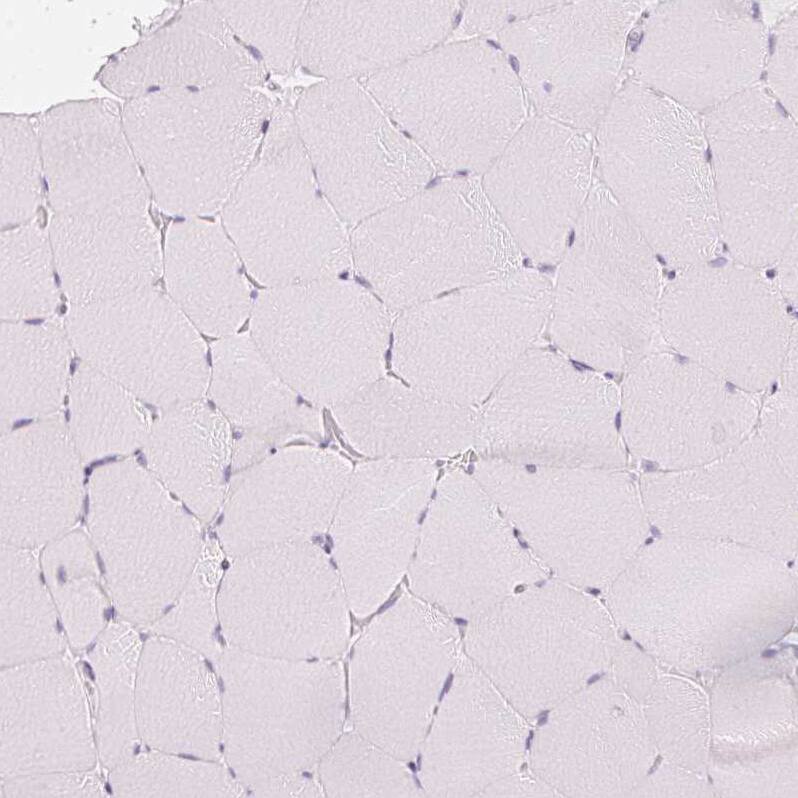 Calbindin D-28K Antibody - BSA Free Immunohistochemistry-Paraffin: Calbindin D-28K Antibody - BSA Free [NBP1-86664]