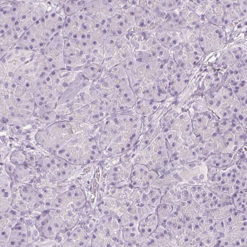 Calbindin D-28K Antibody - BSA Free Immunohistochemistry-Paraffin: Calbindin D-28K Antibody - BSA Free [NBP1-86664]