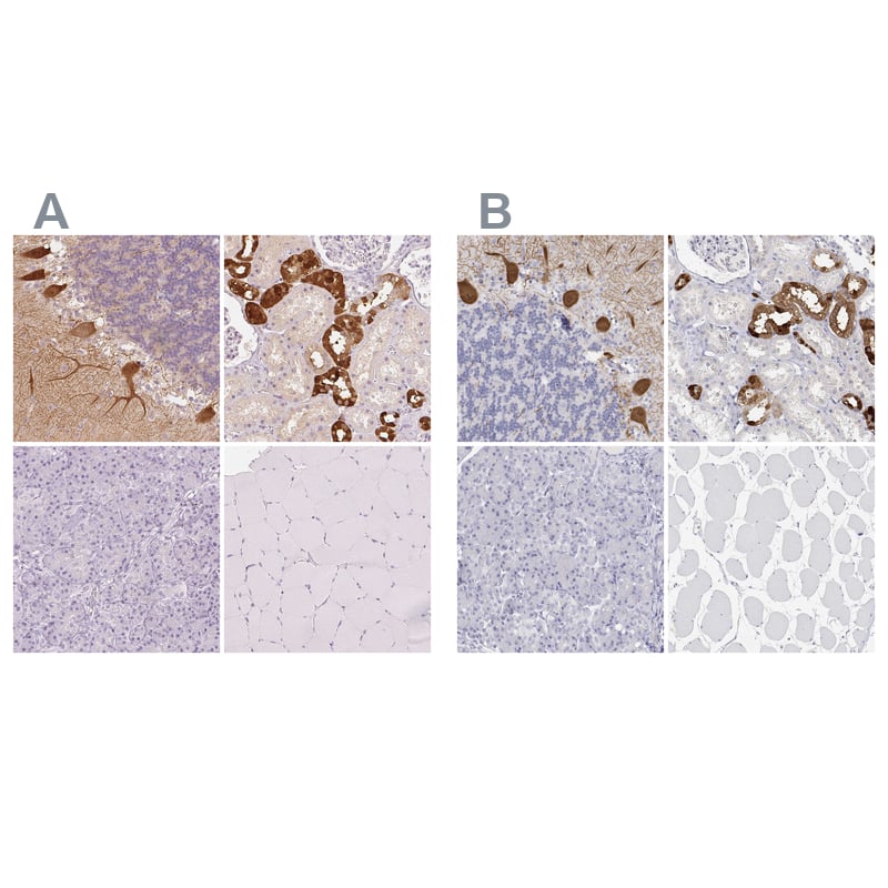 Calbindin D-28K Antibody - BSA Free Immunohistochemistry-Paraffin: Calbindin D-28K Antibody - BSA Free [NBP1-86664]