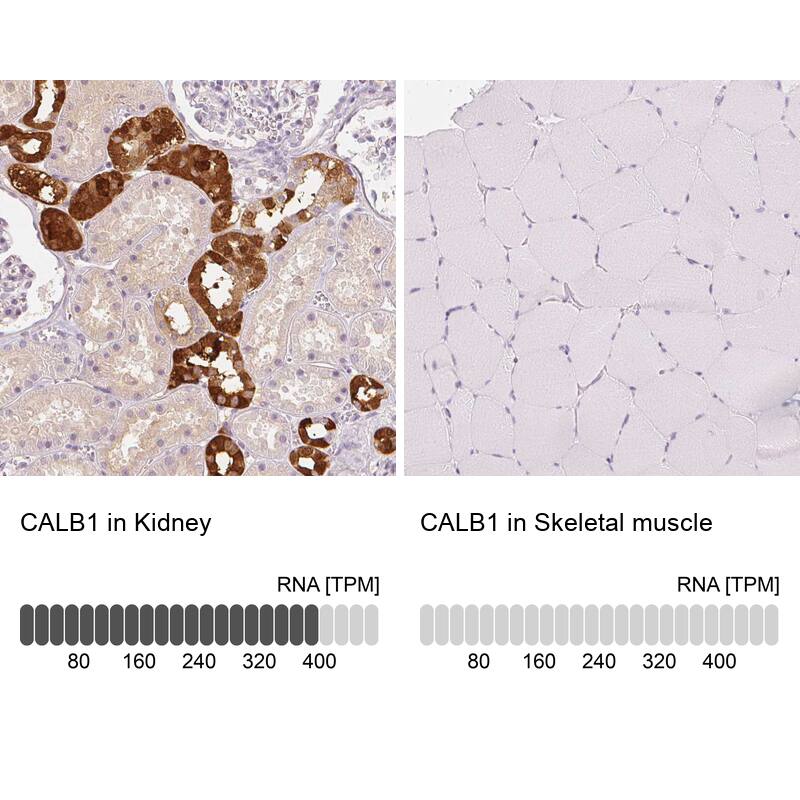 Calbindin D-28K Antibody - BSA Free Immunohistochemistry-Paraffin: Calbindin D-28K Antibody - BSA Free [NBP1-86664]