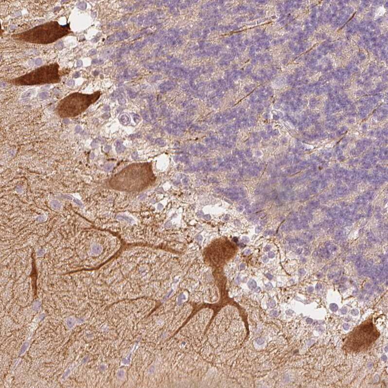 Calbindin D-28K Antibody - BSA Free Immunohistochemistry-Paraffin: Calbindin D-28K Antibody - BSA Free [NBP1-86664]