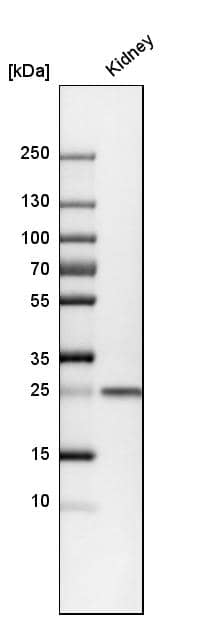 Calbindin D-28K Antibody - BSA Free Western Blot: Calbindin D-28K Antibody - BSA Free [NBP1-86664]