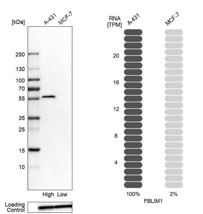 Migfilin Antibody - BSA Free Western Blot: Migfilin Antibody - BSA Free [NBP1-86665]
